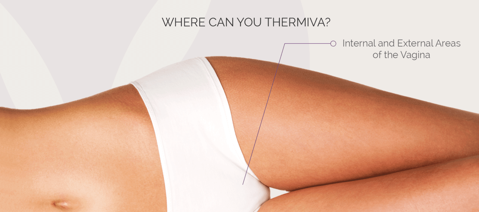 ThermiVa for Vaginal Rejuvenation