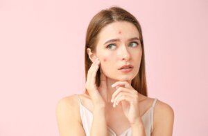 How to Treat Hormonal Acne in Your 30s: Expert Tips from Slater Aesthetics in Atlanta, GA